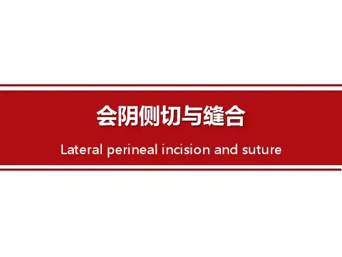 会阴侧切与缝合PPT