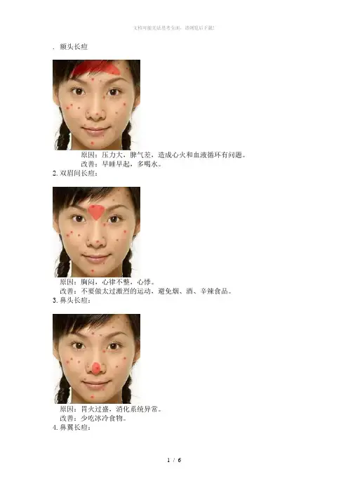 面(脸)部各部位长痘原因