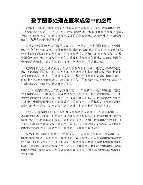 数字图像处理在医学成像中的应用
