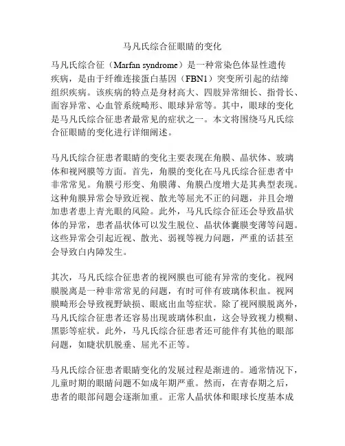 马凡氏综合征眼睛的变化