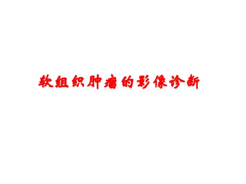 02-王绍武-软组织肿瘤的影像诊断思路