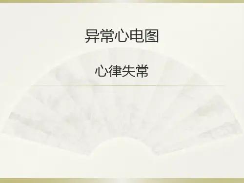 异常心电图精品PPT课件