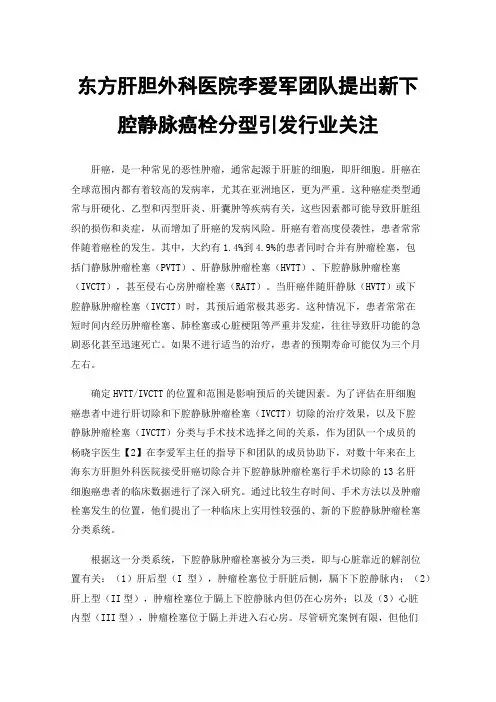 东方肝胆外科医院李爱军团队提出新下腔静脉癌栓分型引发行业关注