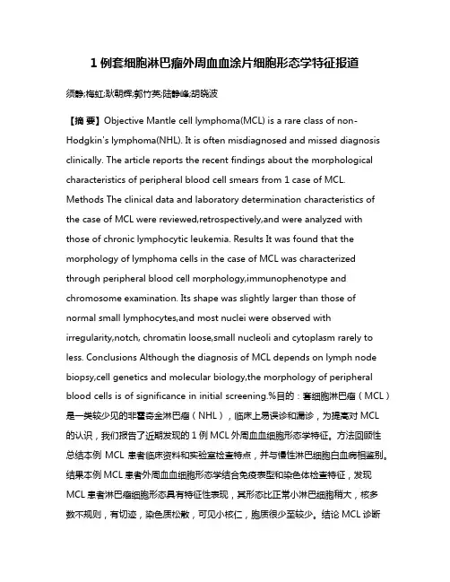 1例套细胞淋巴瘤外周血血涂片细胞形态学特征报道