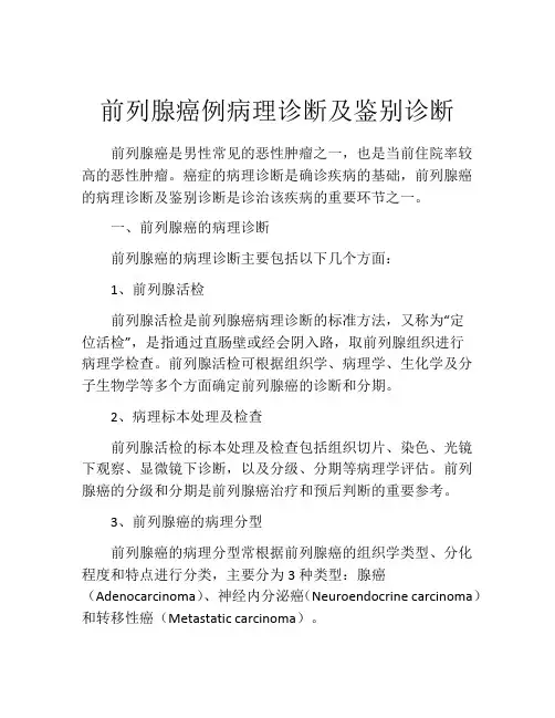前列腺癌例病理诊断及鉴别诊断