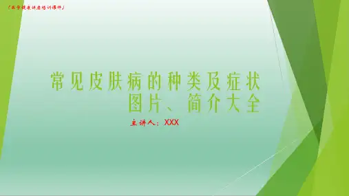 (新)皮肤病的种类及症状图片、简介大全(医学健康讲座培训课件)