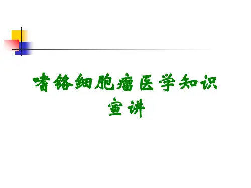 嗜铬细胞瘤医学知识宣讲