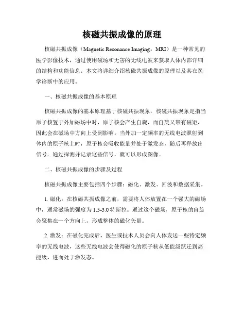核磁共振成像的原理