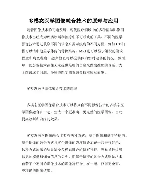 多模态医学图像融合技术的原理与应用