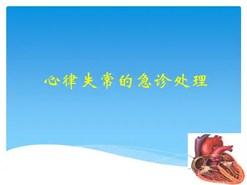 心律失常讲稿