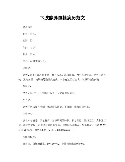 下肢静脉血栓病历范文