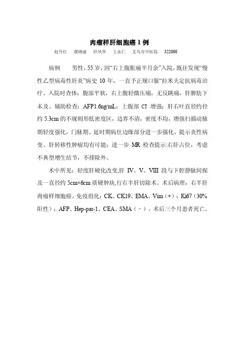 肉瘤样肝癌