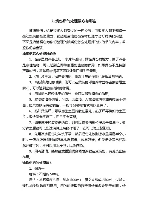 油烧伤后的处理偏方有哪些