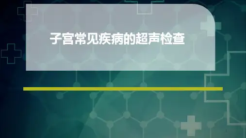 子宫常见病变的超声检查PPT课件