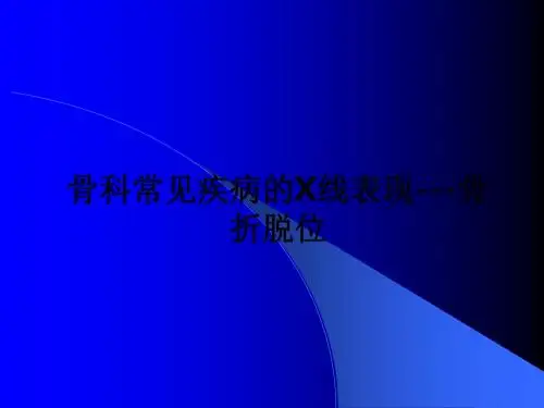 骨科常见疾病的X线表现---骨折脱位ppt课件