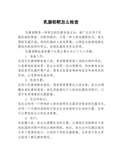 乳腺钼靶怎么检查