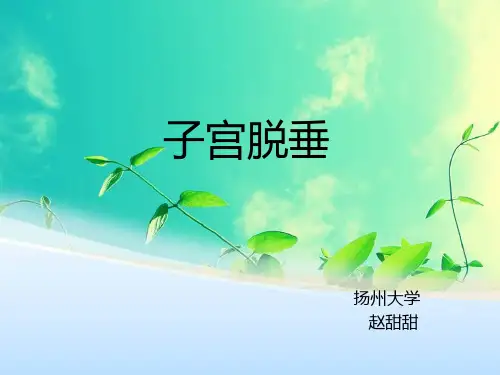 子宫脱垂z演示课件