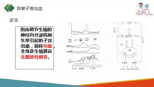 月经失调病人的护理—异常子宫出血的护理(妇产科护理课件)