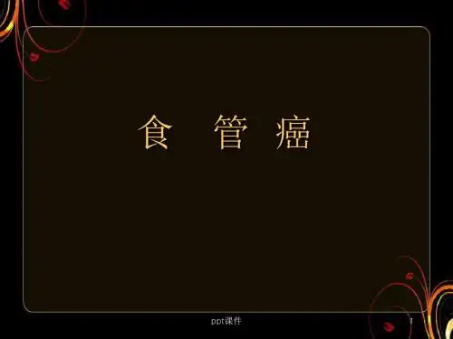 食管癌治疗进展  ppt课件