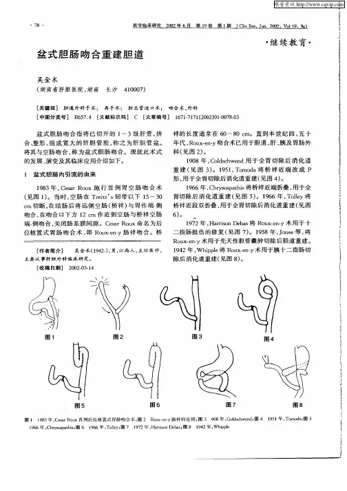 盆式胆肠吻合重建胆道