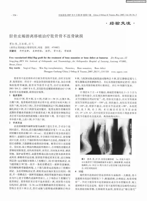 胫骨皮瓣游离移植治疗肱骨骨不连骨缺损