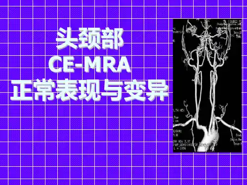 头颈部CE-MRA正常表现与变异