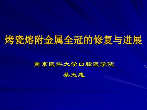 烤瓷熔附金属全冠修复成功的关键要素南京医科大学附属口腔医院