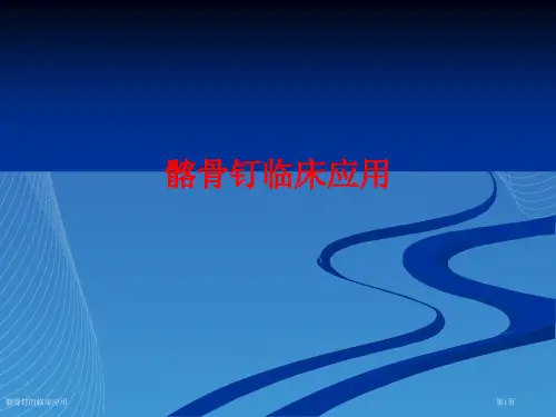髂骨钉的临床应用