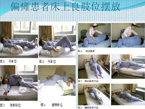 偏瘫患者良肢位摆放