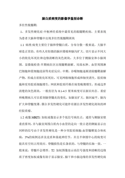 脑白质病变的影像学鉴别诊断