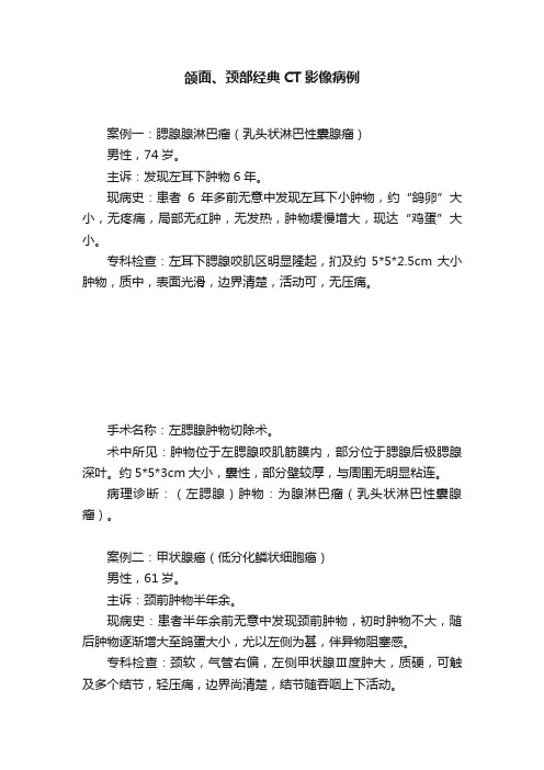 颌面、颈部经典CT影像病例
