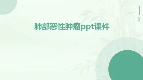 肺部恶性肿瘤PPT课件