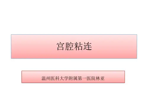 宫腔粘连1