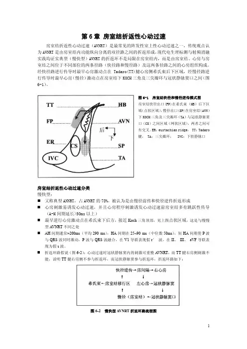 06房室结折返性心动过速