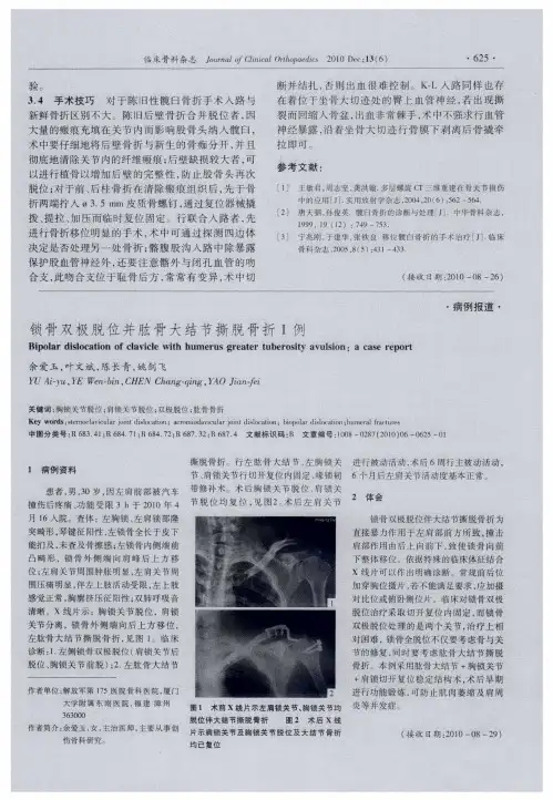 锁骨双极脱位并肱骨大结节撕脱骨折1例