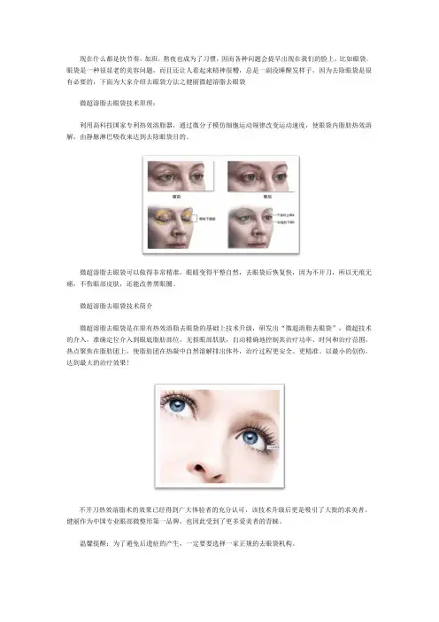 热效溶脂去眼袋技术原理