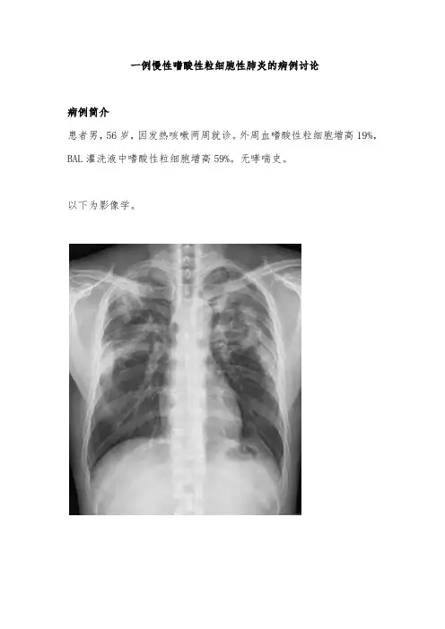 一例慢性嗜酸性粒细胞性肺炎的病例讨论