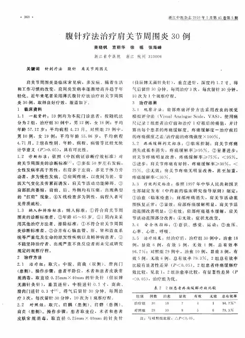 腹针疗法治疗肩关节周围炎30例