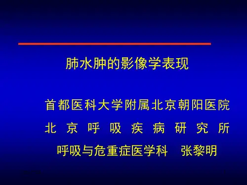 肺水肿影像学表现PPT课件