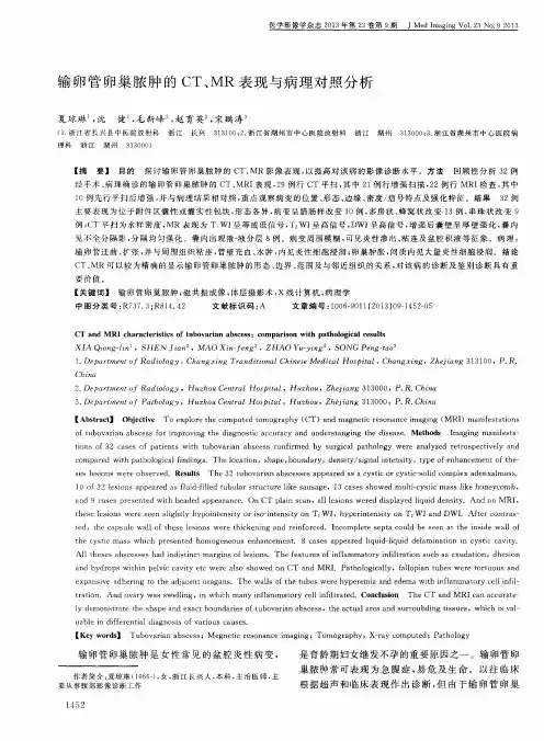 输卵管卵巢脓肿的CT、MR表现与病理对照分析