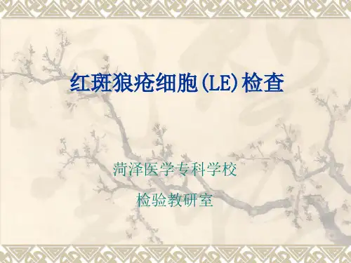 红斑狼疮细胞(LE)检查