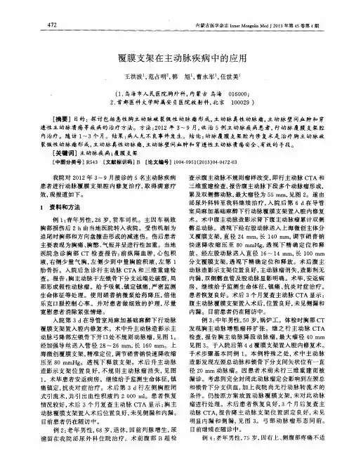 覆膜支架在主动脉疾病中的应用