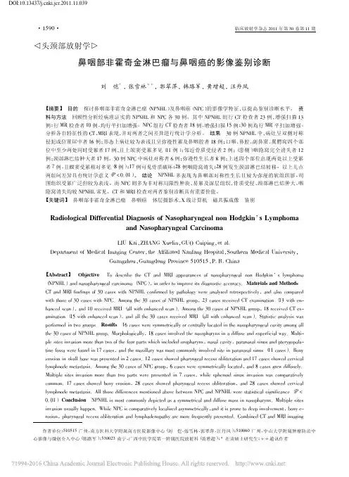 鼻咽部非霍奇金淋巴瘤与鼻咽癌的影像鉴别诊断_刘恺