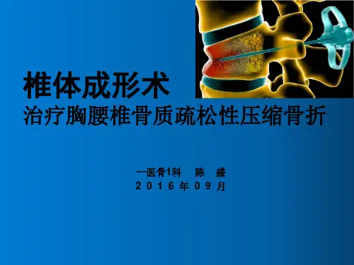 椎体成形术
