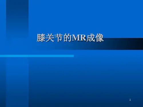 膝关节的MR成像参考PPT