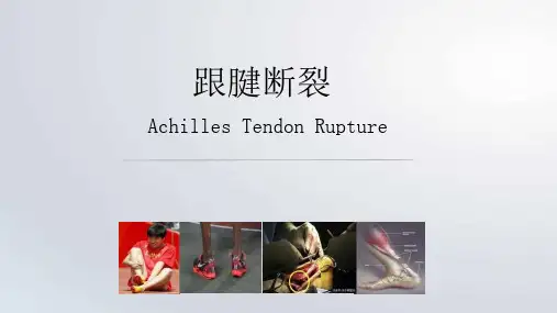 跟腱断裂ppt课件