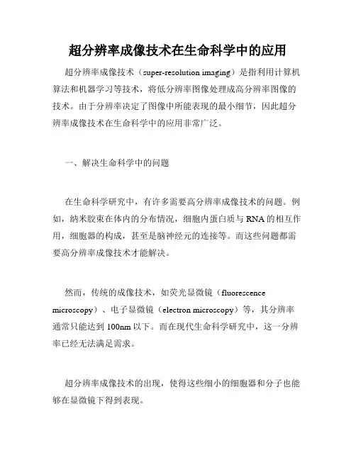 超分辨率成像技术在生命科学中的应用