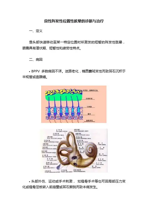 良性阵发性位置性眩晕的诊断与治疗