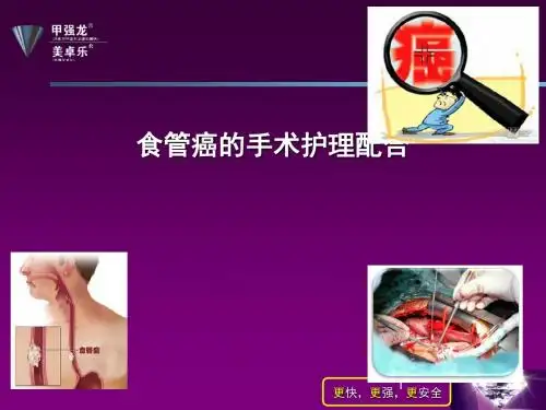 食管癌的手术护理配合PPT课件