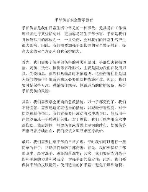 手部伤害安全警示教育